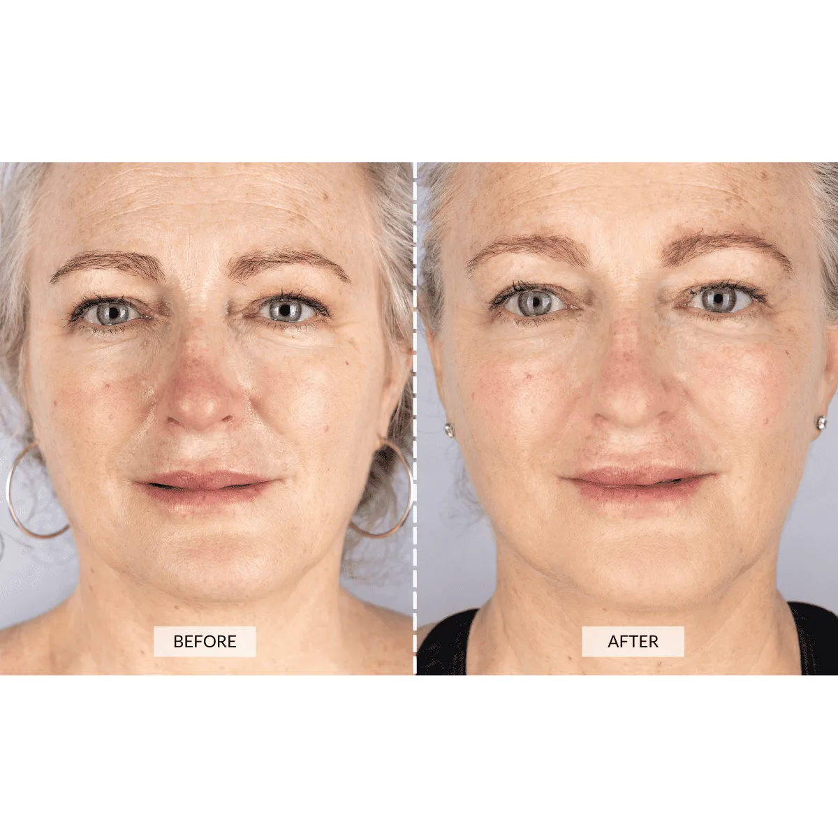 CurrentBody Skin LED Light Therapy Face Mask